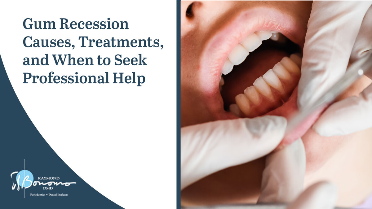 Gum Recession Causes, Treatments, and When to Seek Professional Help